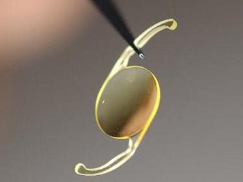 低溫等離子表面處理技術(shù)提高人工晶狀體的親水性，解決術(shù)后炎癥問題-普樂斯等離子清洗機(jī)